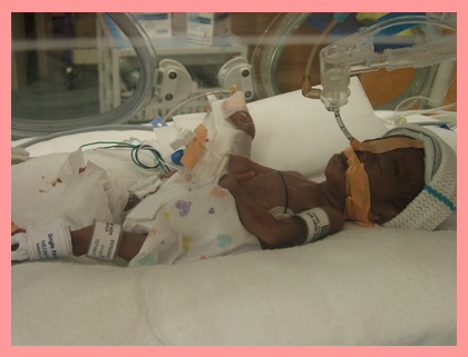 Neonatal Intensive Care Unit (NICU)